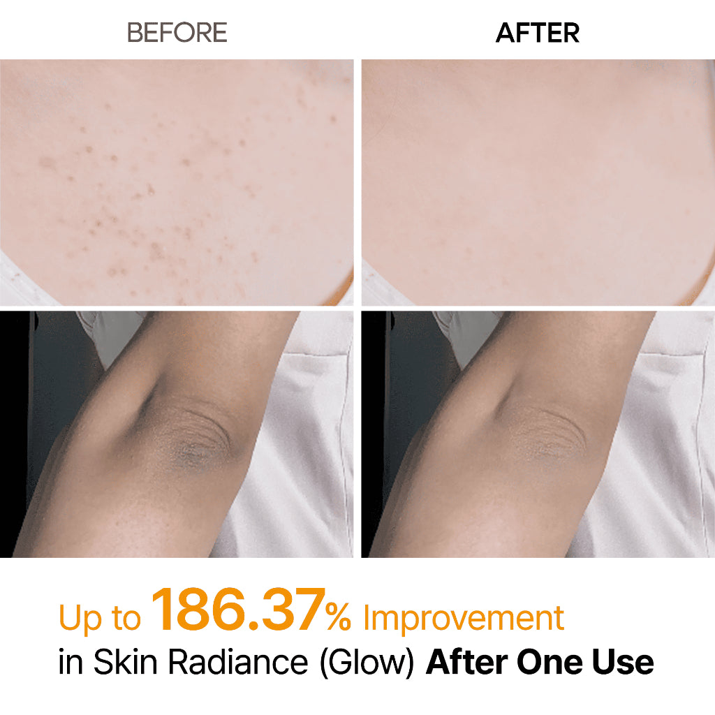 Peel Shot Exfoliating Kojic Acid Turmeric Spray