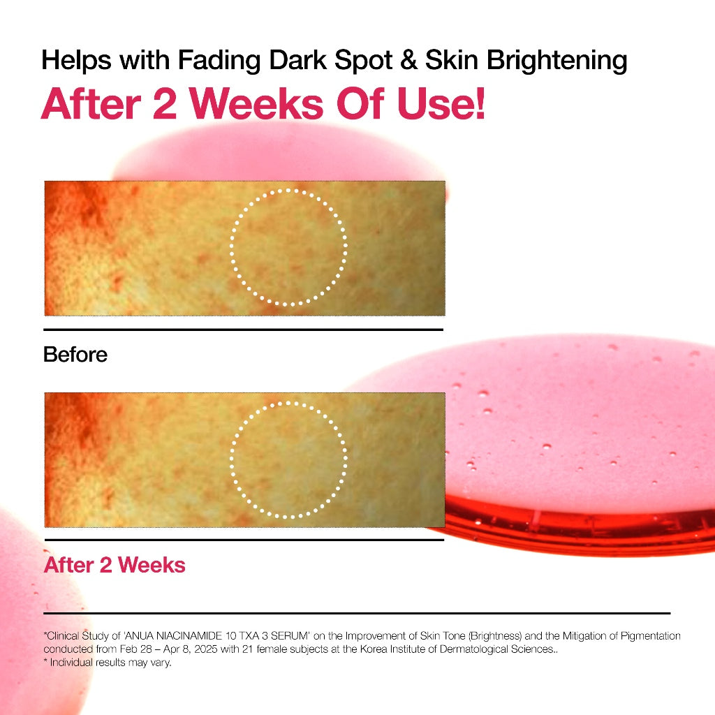 Niacinamide 10 TXA 3 Dark Spot Correcting Serum