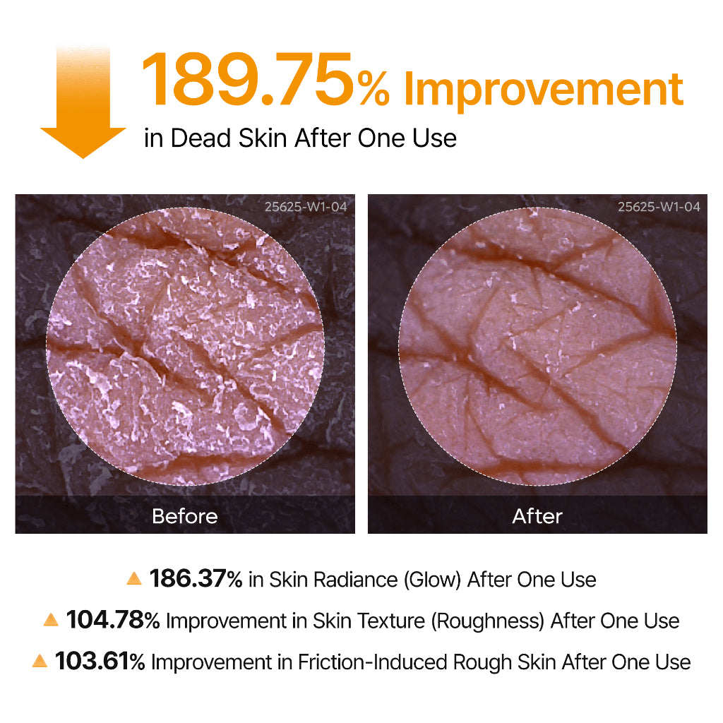 Peel Shot Exfoliating Kojic Acid Turmeric Spray