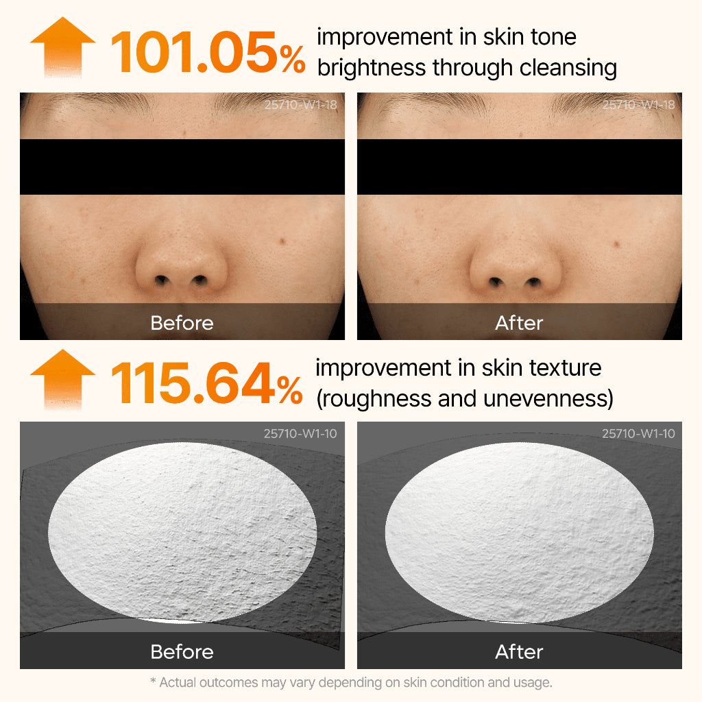 Peel Shot Exfoliating Kojic Acid Turmeric Serum