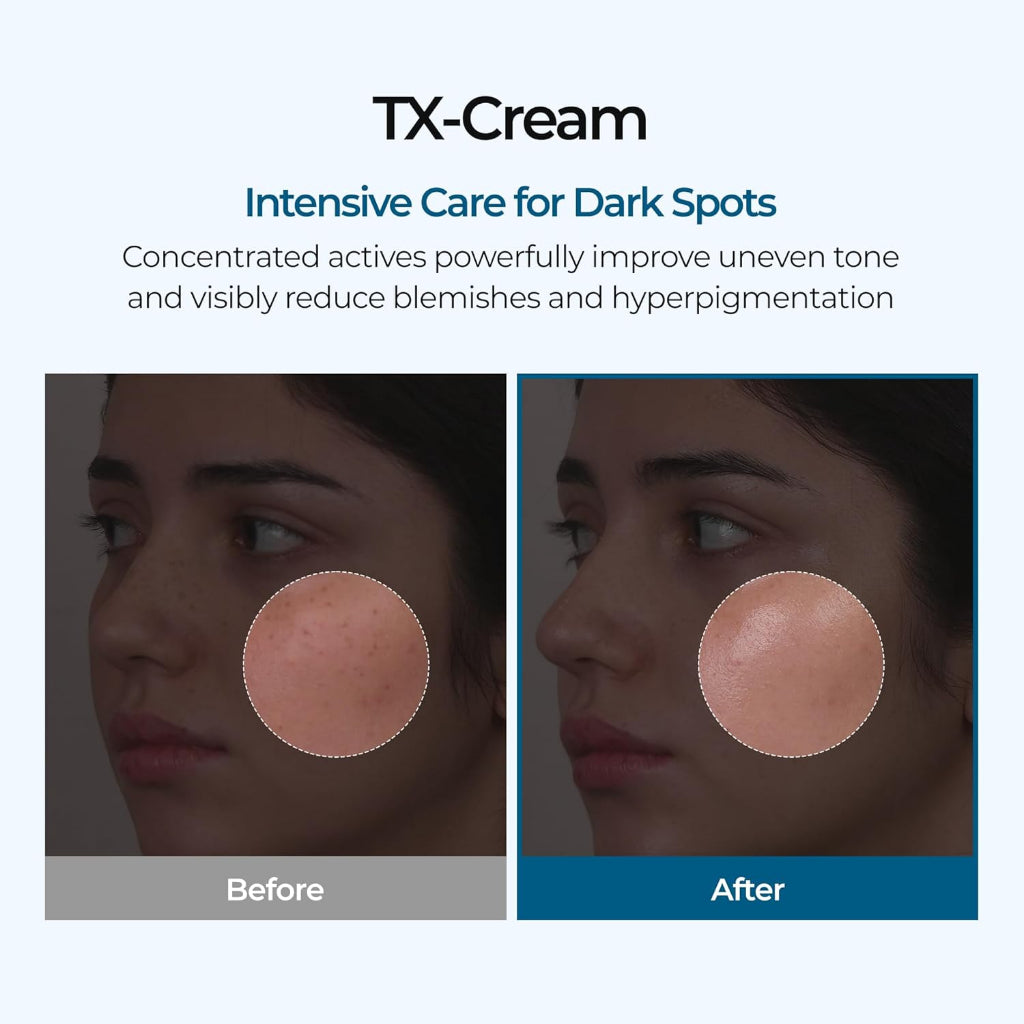 TX-Cream