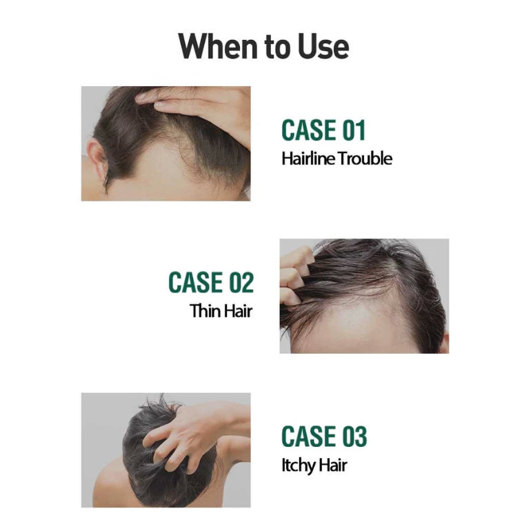 Daily Anti-Hair Loss Herb Hair Tonic