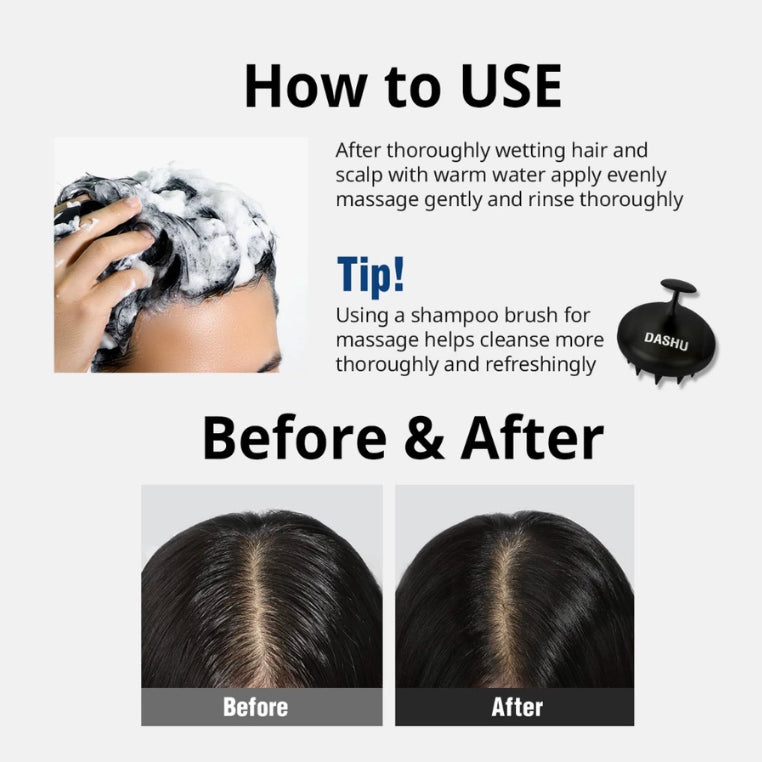Daily Anti-Hair Loss Scalp Shampoo