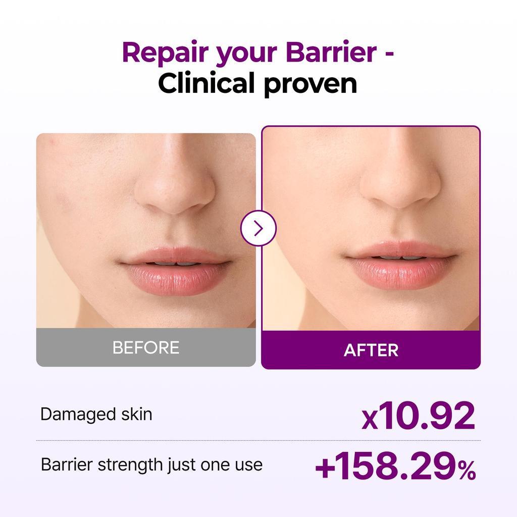 Calcium Bonding Barrier Repair Toner